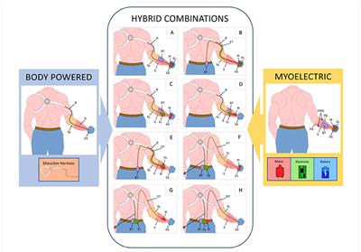 Usability Assessment of Body Controlled Electric Hand Prostheses: A Pilot Study